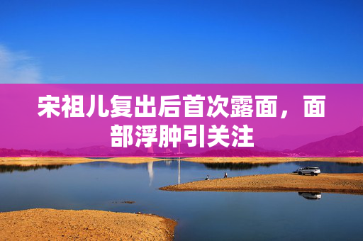 宋祖儿复出后首次露面，面部浮肿引关注